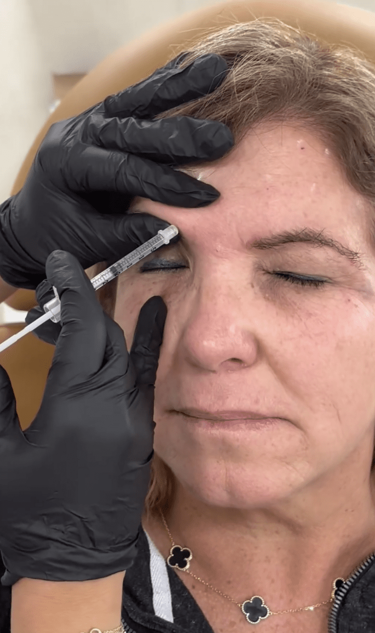 botox fort myers